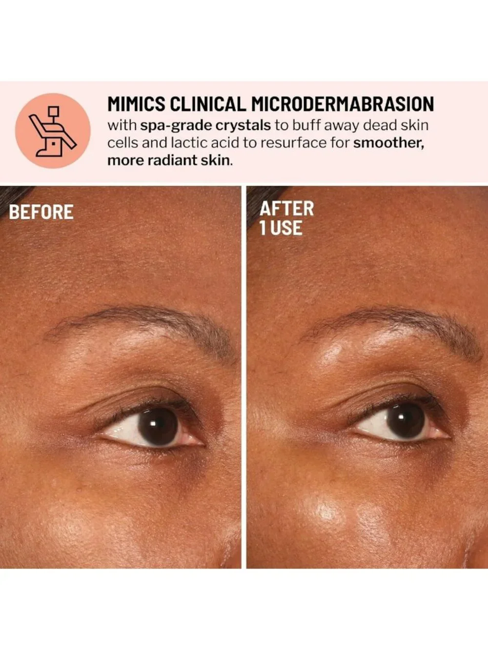 Travel Size Microdermabrasion Exfoliator - Refines Texture, Reduces Fine Lines